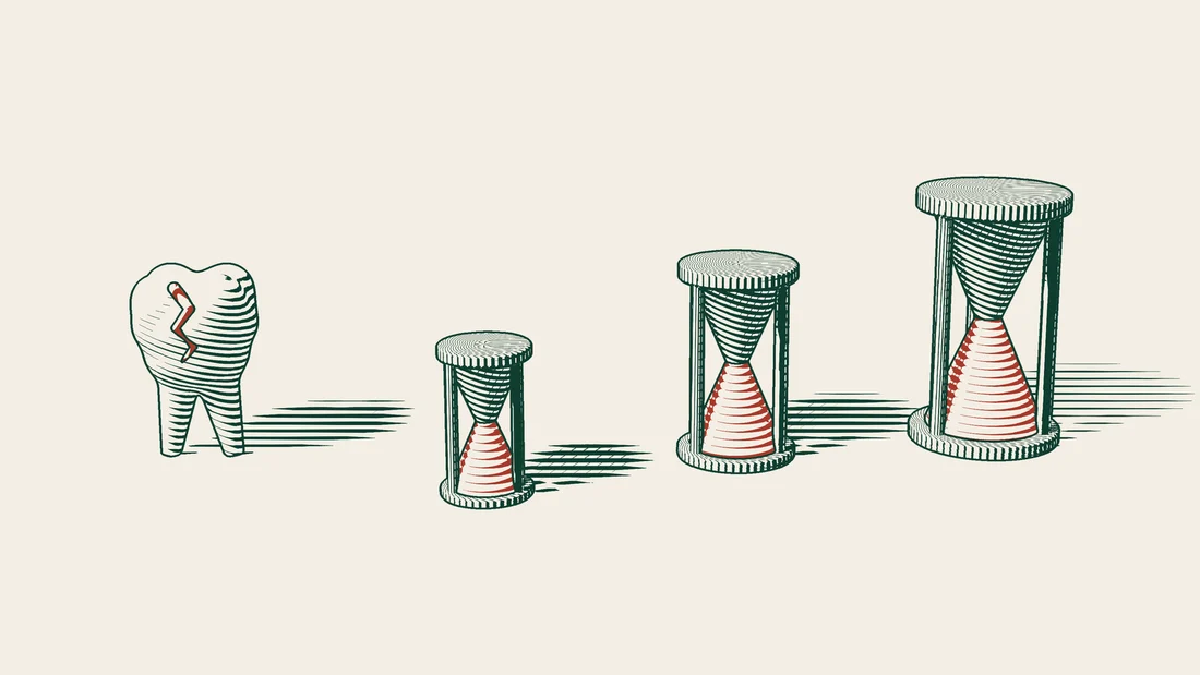 A cracked tooth model beside three hourglasses of different sizes, with the smallest one placed in front.